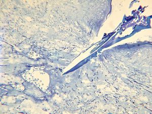stabbed hypostom of the tick … toluidine-stained semithin section stabbed hypostom of the tick … toluidine-stained semithin section